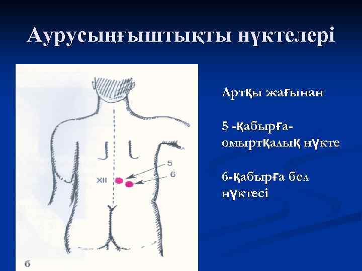 Аурусыңғыштықты нүктелері Артқы жағынан 5 -қабырғаомыртқалық нүкте 6 -қабырға бел нүктесі 