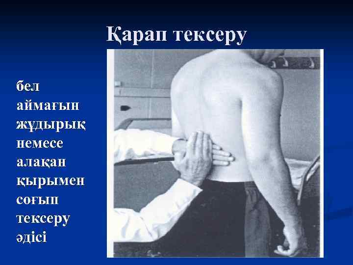 Қарап тексеру бел аймағын жұдырық немесе алақан қырымен соғып тексеру әдісі 
