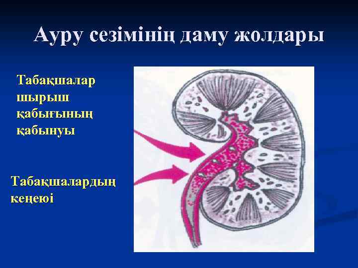 Ауру сезімінің даму жолдары Табақшалар шырыш қабығының қабынуы Табақшалардың кеңеюі 