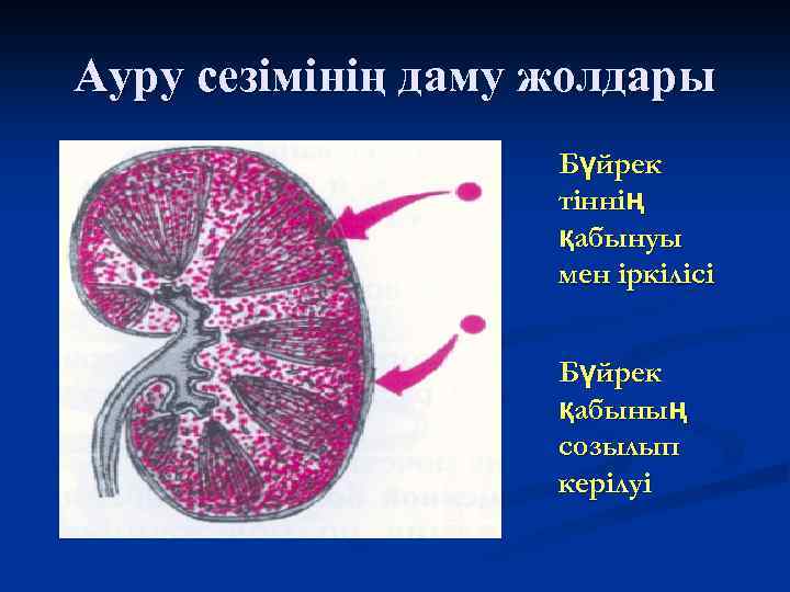 Презентация несеп тас ауруы