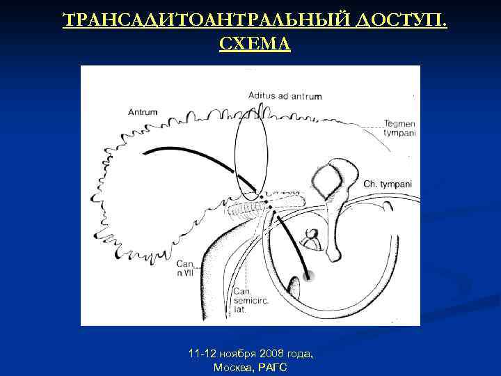 ТРАНСАДИТОАНТРАЛЬНЫЙ ДОСТУП. СХЕМА 11 -12 ноября 2008 года, Москва, РАГС 