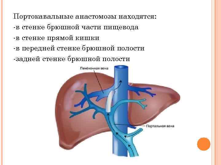 Анастомозы брюшной стенки