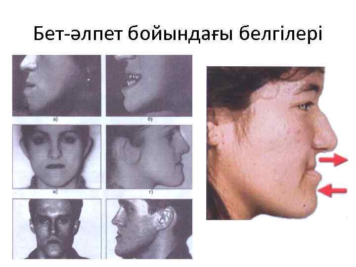 Бет-әлпет бойындағы белгілері 