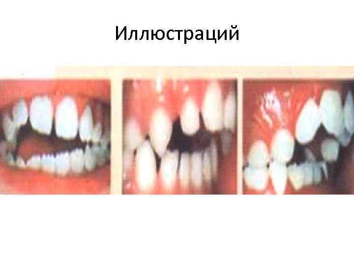 Иллюстраций 