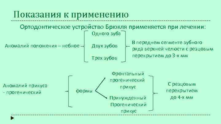 Показания к применению Ортодонтическое устройство Брюкля применяется при лечении: Одного зуба Аномалий положения –