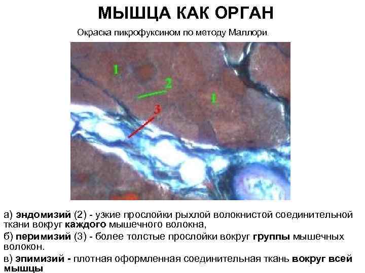 МЫШЦА КАК ОРГАН Окраска пикрофуксином по методу Маллори. а) эндомизий (2) - узкие прослойки