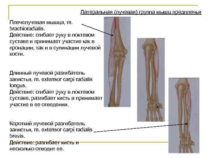Латеральная (лучевая) группа мышц предплечья Плечелучевая мышца, m. brachioradialis. Действие: сгибает руку в локтевом