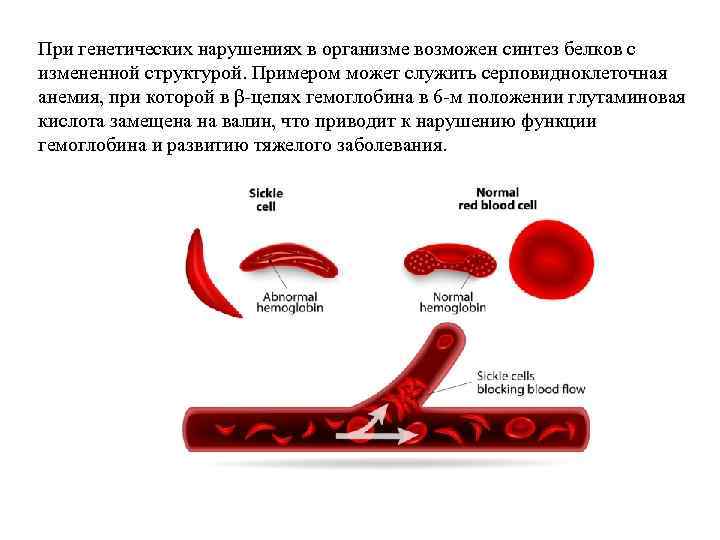 При генетических нарушениях в организме возможен синтез белков с измененной структурой. Примером может служить