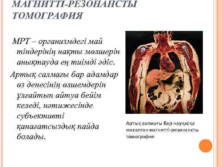 МАГНИТТІ-РЕЗОНАНСТЫ ТОМОГРАФИЯ МРТ – организмдегі май тіндерінің нақты мөлшерін анықтауда ең тиімді әдіс. Артық