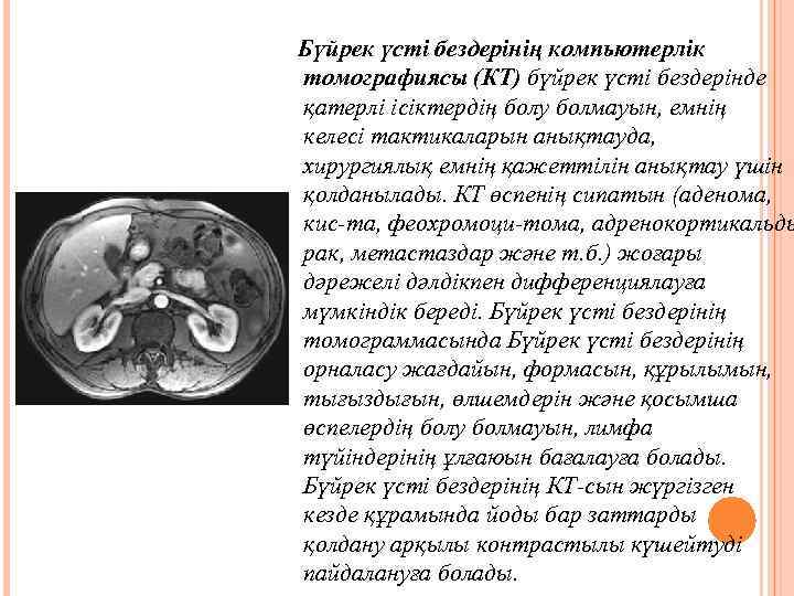  Бүйрек үсті бездерінің компьютерлік томографиясы (КТ) бүйрек үсті бездерінде қатерлі ісіктердің болу болмауын,
