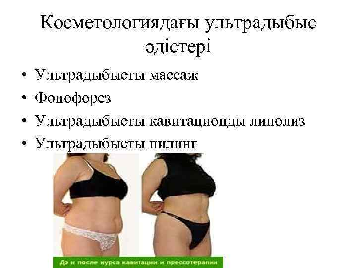 Косметологиядағы ультрадыбыс әдістері • • Ультрадыбысты массаж Фонофорез Ультрадыбысты кавитационды липолиз Ультрадыбысты пилинг 