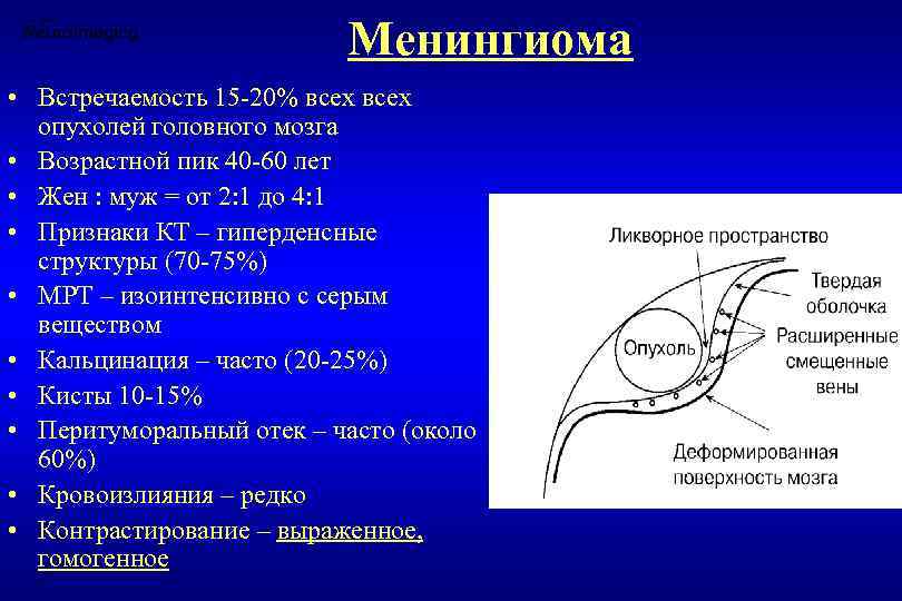 Менингиома • Встречаемость 15 -20% всех опухолей головного мозга • Возрастной пик 40 -60