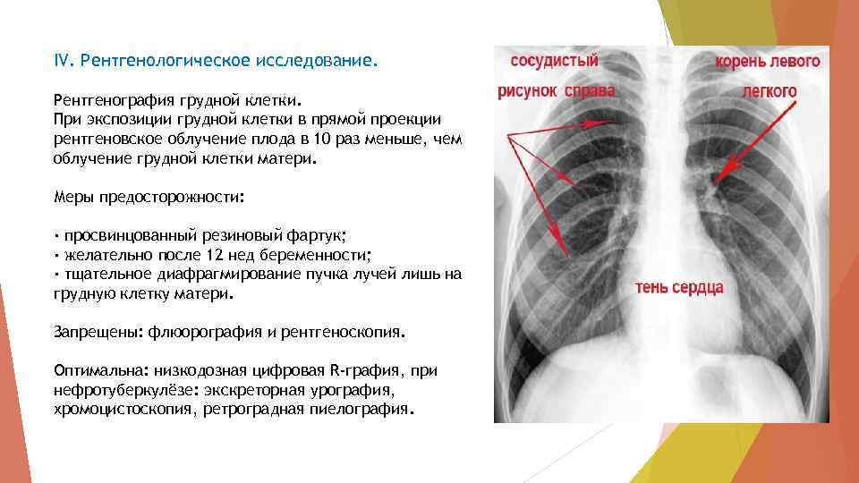 Отличие флюорографии от рентгена грудной