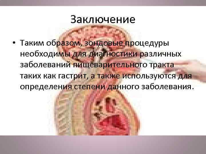 Заключение • Таким образом, зондовые процедуры необходимы для диагностики различных заболеваний пищеварительного тракта таких