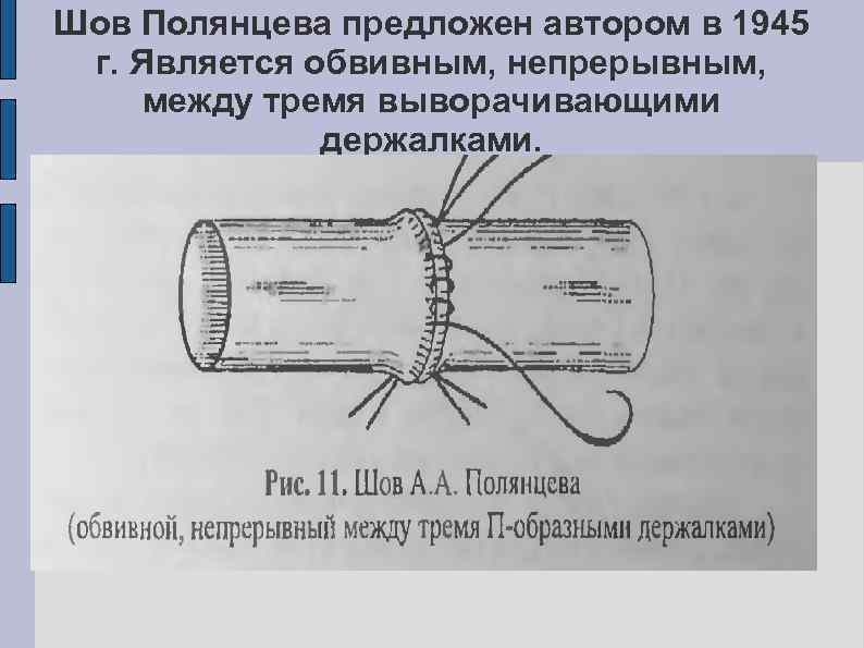 Сосудистый шов методы наложения