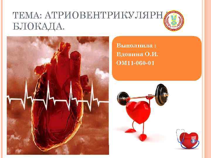 ТЕМА: АТРИОВЕНТРИКУЛЯРНАЯ БЛОКАДА. Выполнила : Вдовина О. И. ОМ 11 -060 -01 