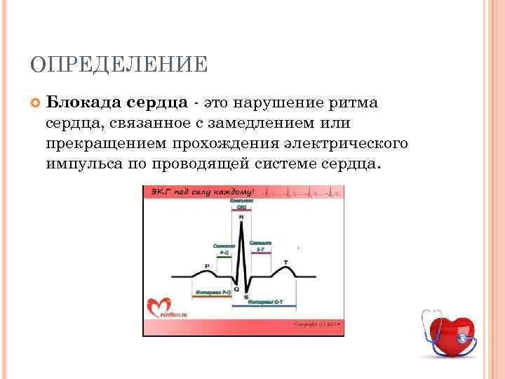 ОПРЕДЕЛЕНИЕ Блокада сердца - это нарушение ритма сердца, связанное с замедлением или прекращением прохождения
