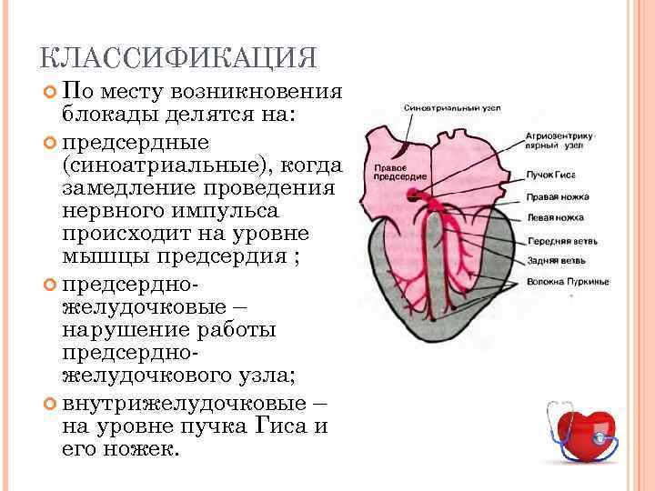 КЛАССИФИКАЦИЯ По месту возникновения блокады делятся на: предсердные (синоатриальные), когда замедление проведения нервного импульса