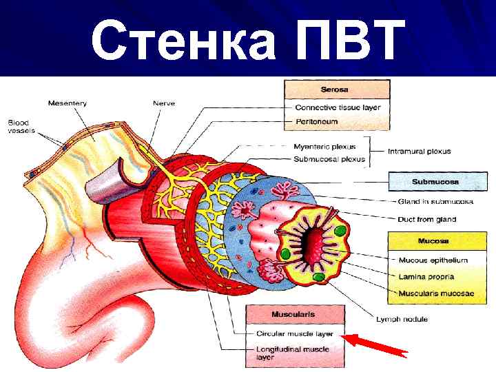 Стенка ПВТ 