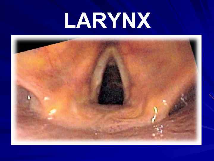 LARYNX 