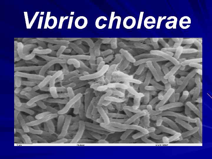 Vibrio cholerae 