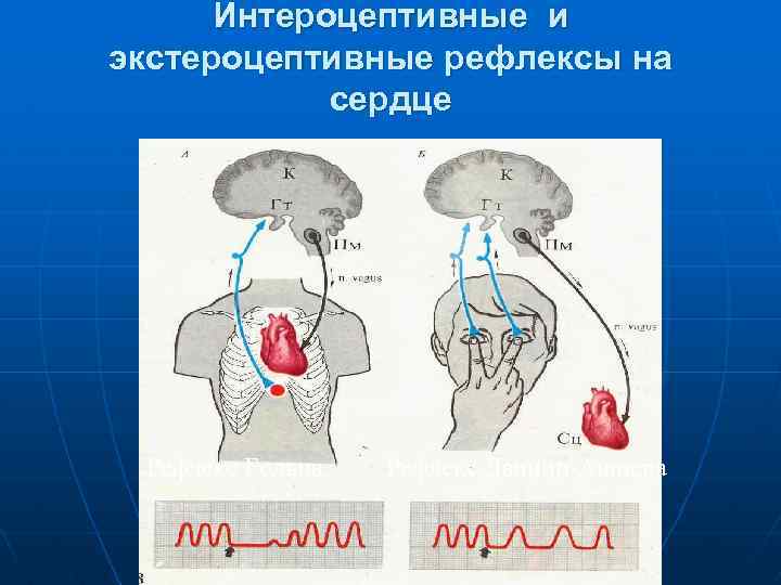 Интероцептивные и экстероцептивные рефлексы на сердце Рефлекс Гольца Рефлекс Данини-Ашнера 