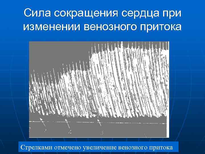 Сила сокращения сердца при изменении венозного притока Стрелками отмечено увеличение венозного притока 