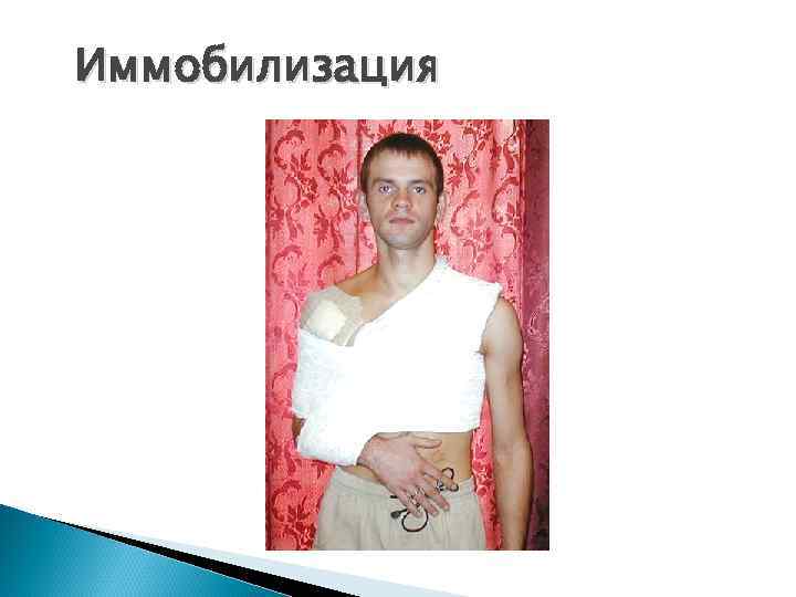 Иммобилизация 
