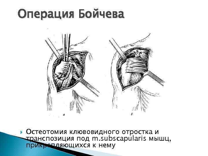 Винирная пластика и межкортикальная остеотомия презентация