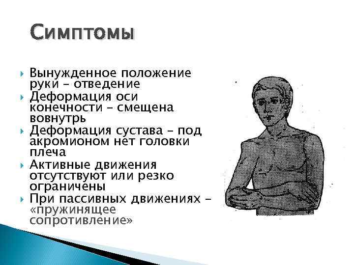 Симптомы Вынужденное положение руки – отведение Деформация оси конечности – смещена вовнутрь Деформация сустава