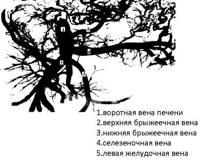 5 1 4 2 3 1. воротная вена печени 2. верхняя брыжеечная вена 3.