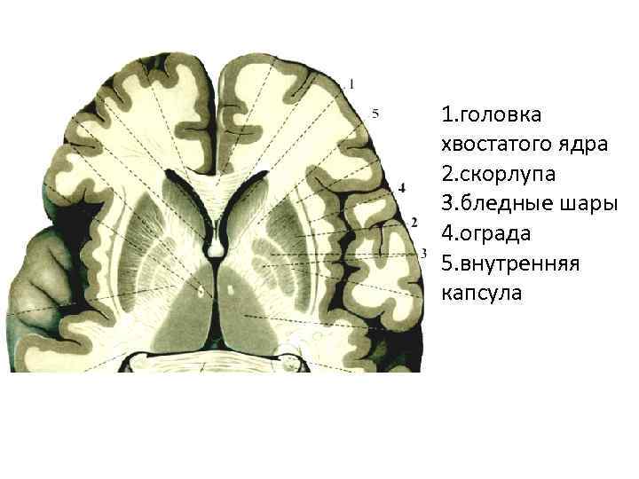 Внутренняя головка. Головка хвостатого ядра головного мозга. Хвостатое ядро внутренняя капсула. Базальные ядра внутренняя капсула. Бледный шар скорлупа хвостатое ядро.