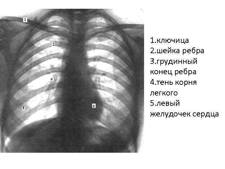 Между 6 и 7 ребром