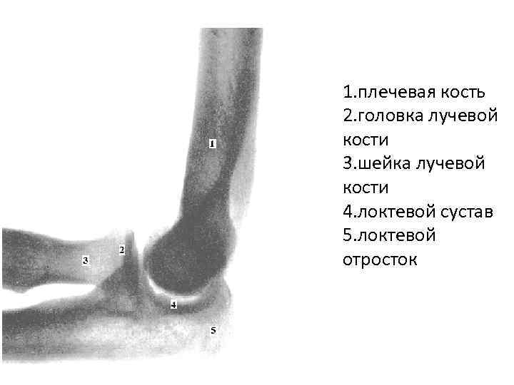 Головка лучевой кости