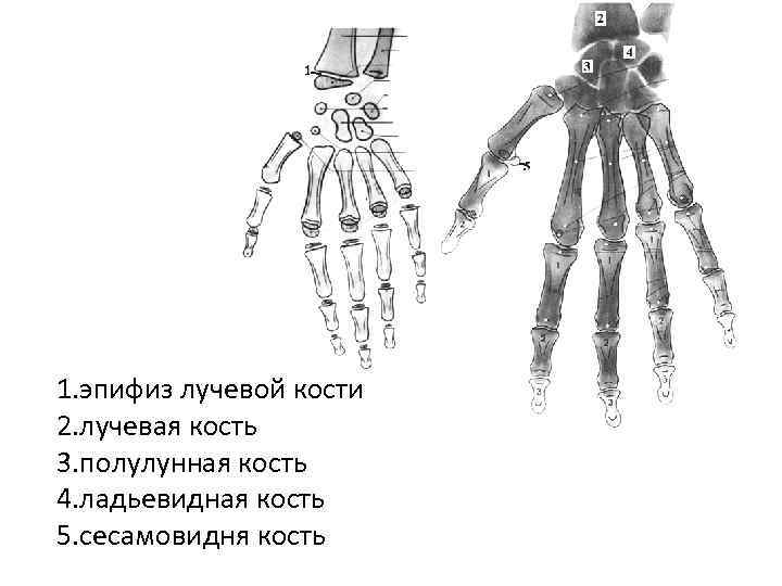 1. эпифиз лучевой кости 2. лучевая кость 3. полулунная кость 4. ладьевидная кость 5.
