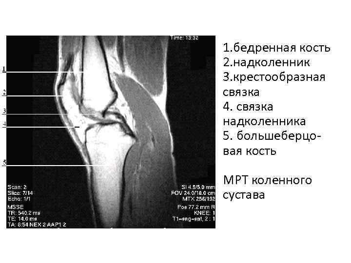 Где находится надколенник у человека фото