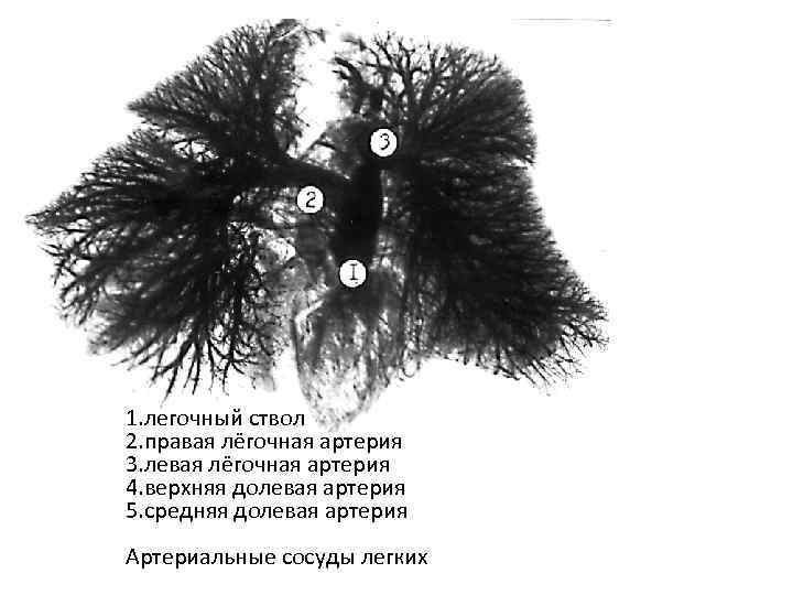 1. легочный ствол 2. правая лёгочная артерия 3. левая лёгочная артерия 4. верхняя долевая