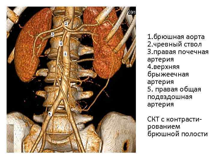 Аорта брюшной полости. Синтопия чревного ствола. Брюшная аорта чревный ствол. Анатомия чревного ствола кт. Анатомия брюшной аорты чревного ствола.