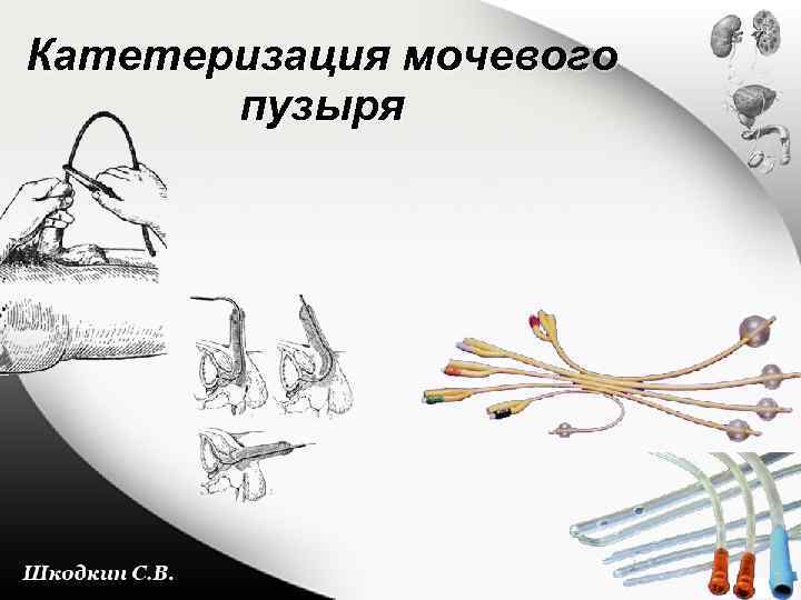Катетеризация мочевого пузыря 