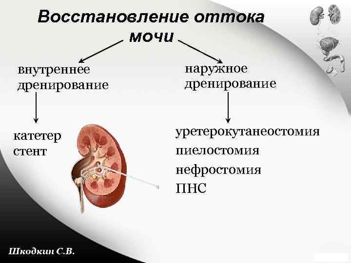 Восстановление оттока мочи внутреннее дренирование катетер стент наружное дренирование уретерокутанеостомия пиелостомия нефростомия ПНС 