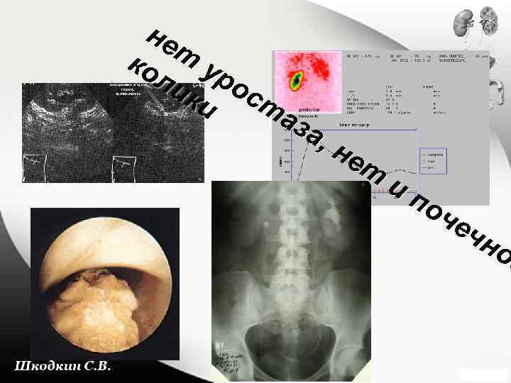 не т ко ур ли ос ки та за , н ет ип оч