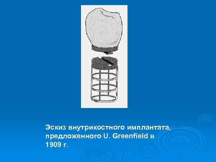 Эскиз внутрикостного имплантата, предложенного U. Greenfield в 1909 г. 