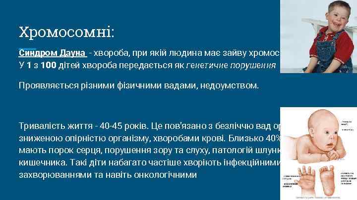 Хромосомні: Синдром Дауна - хвороба, при якій людина має зайву хромосому. У 1 з