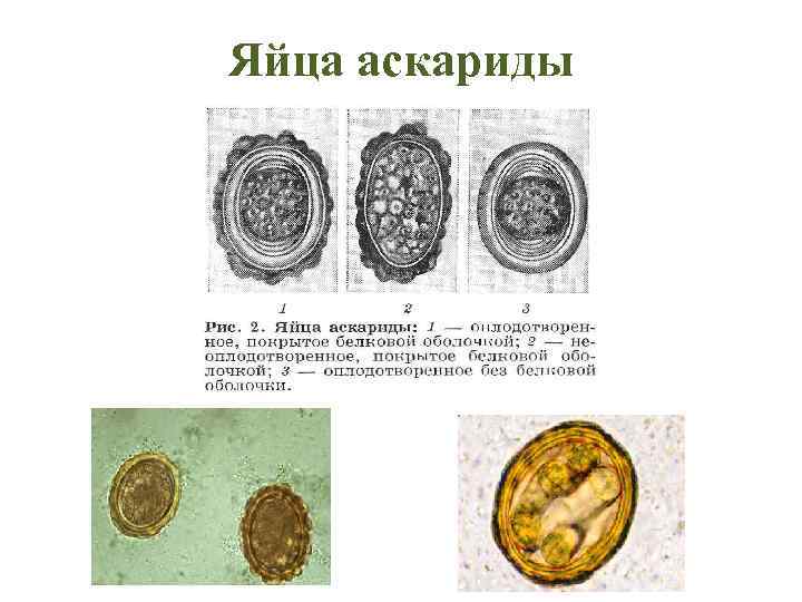 Яйца аскариды 