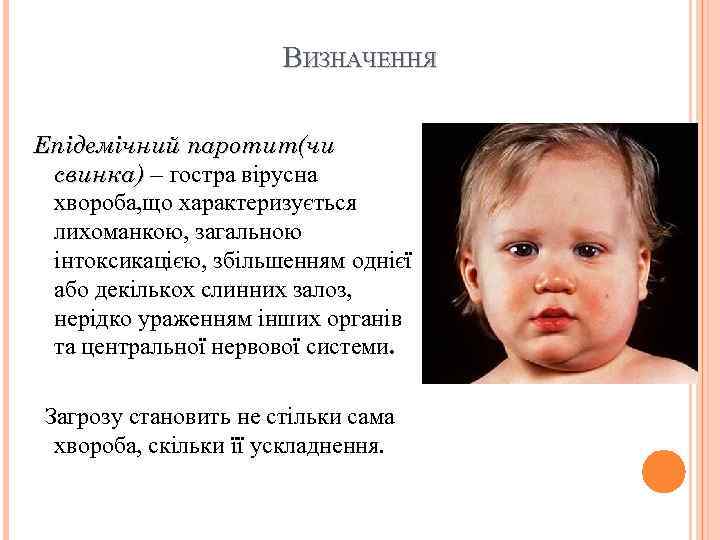 ВИЗНАЧЕННЯ Епідемічний паротит(чи свинка) – гостра вірусна хвороба, що характеризується лихоманкою, загальною інтоксикацією, збільшенням