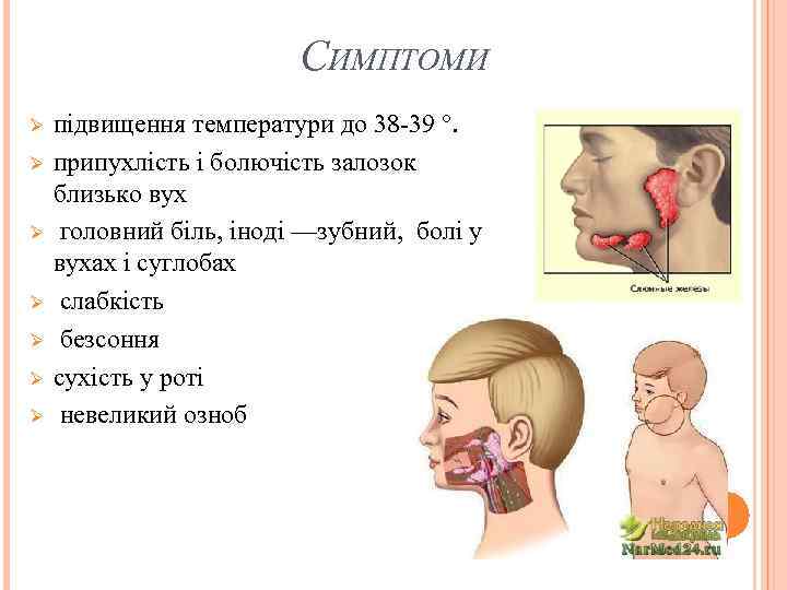 СИМПТОМИ Ø Ø Ø Ø підвищення температури до 38 -39 °. припухлість і болючість