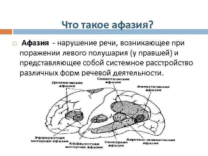 Динамическая афазия это моторная