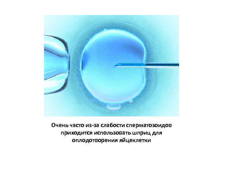 Очень часто из-за слабости сперматозоидов приходится использовать шприц для оплодотворения яйцеклетки 