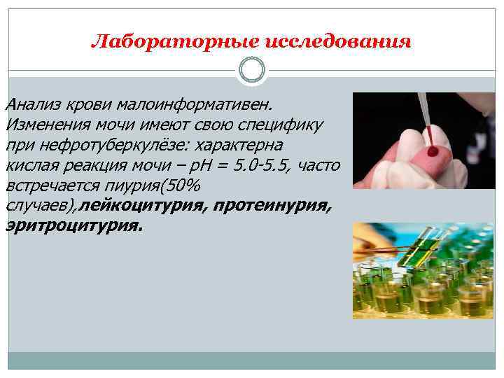 Лабораторные исследования Анализ крови малоинформативен. Изменения мочи имеют свою специфику при нефротуберкулёзе: характерна кислая