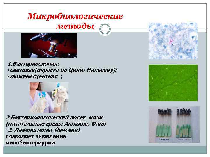 Микробиологические методы 1. Бактериоскопия: • световая(окраска по Цилю-Нильсену); • люминесцентная ; 2. Бактериологический посев